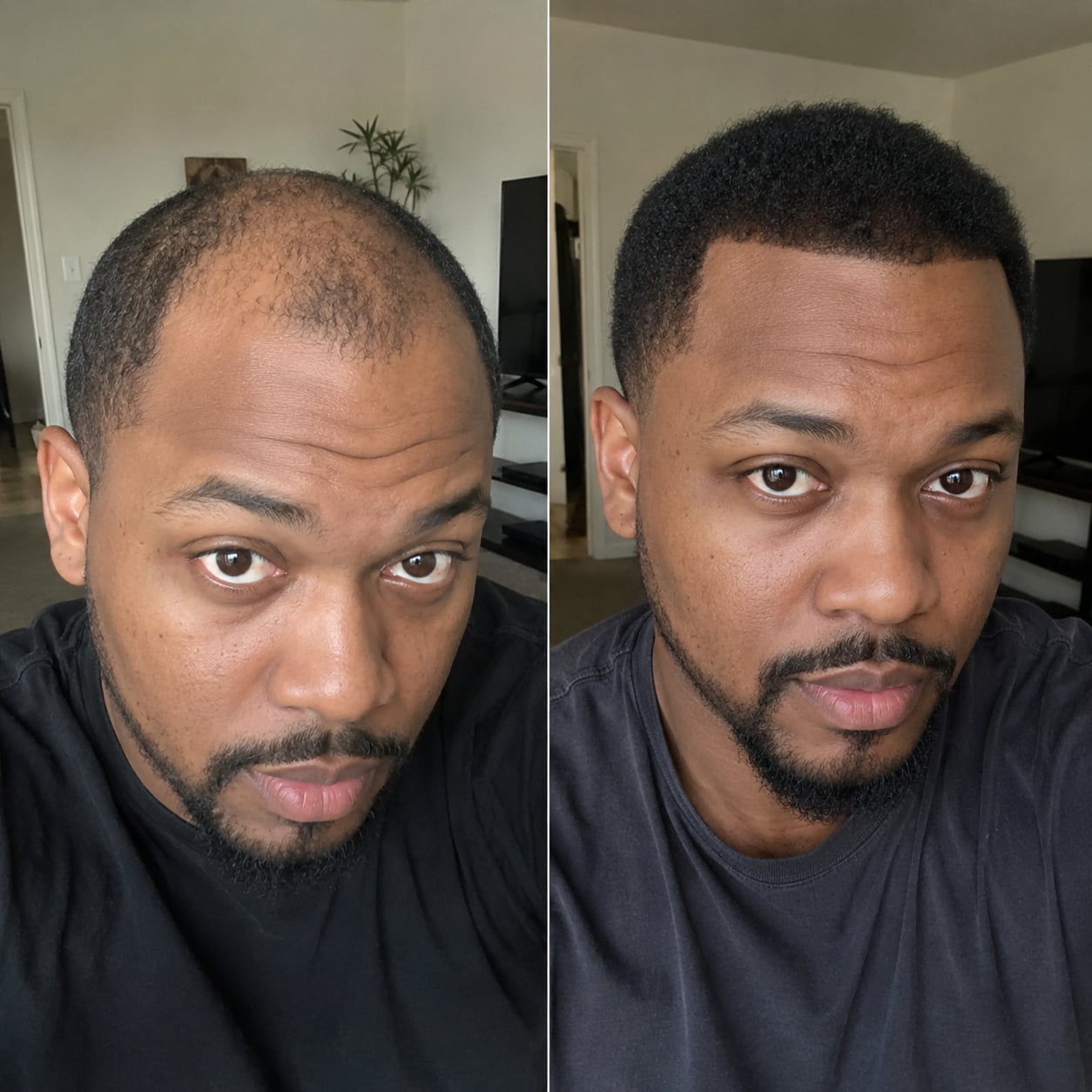 Customer real hair growth result