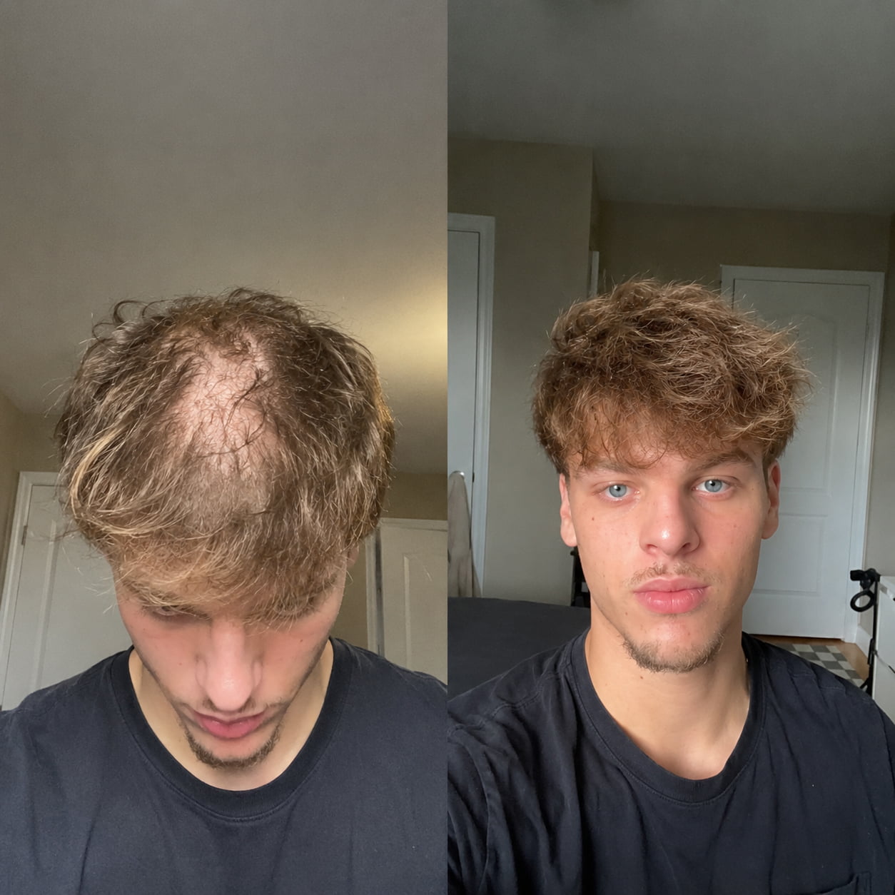 Customer hair growth before and after result