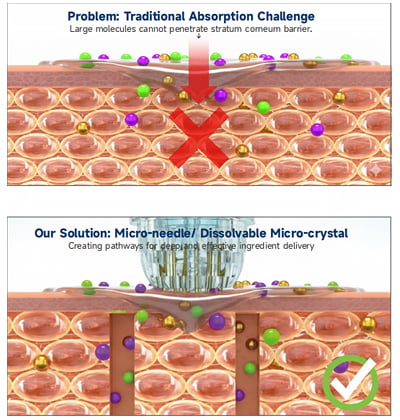 Advanced transdermal cell technology